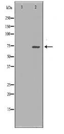 SDHA Antibody