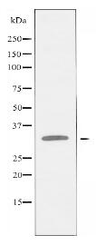 RPL5 Antibody