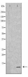 SPINK1 Antibody