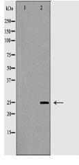 CD8A Antibody