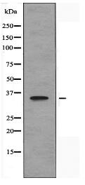 TAS2R5 Antibody