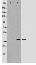 TPMT Antibody