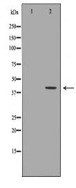 KIR2DL1 Antibody
