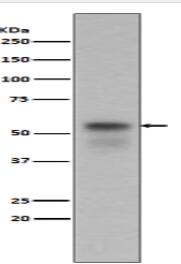 Phospho-Smad3 (S423 + S425) Antibody