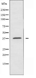 TAS2R14 Antibody