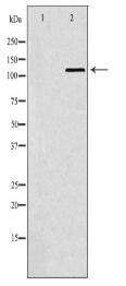 SMARCA5 Antibody