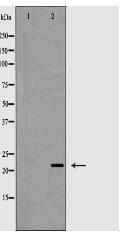 Claudin 4 Antibody