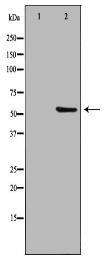 PPP2R3C Antibody