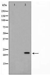 NM23 Antibody