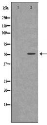 THRB Antibody