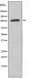 PC Antibody