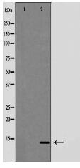 Trefoil factor 2（TFF2） Antibody