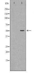 HNRNPK Antibody