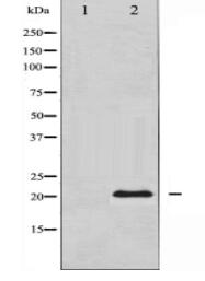 Survivin Antibody