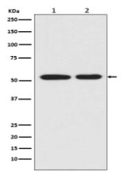 Mutant p53 Antibody