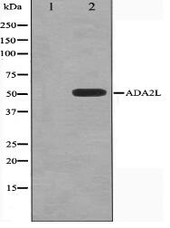 ADA2L Antibody