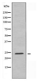 RAB2A Antibody