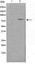 FER Antibody