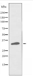 RASD2 Antibody