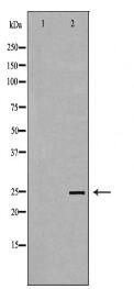 TK1 Antibody