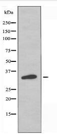 OR5AK3P Antibody