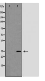 PGP9.5 Antibody