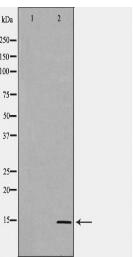 SAA1 Antibody