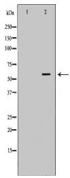 PCCB Antibody