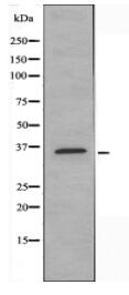 MAGEA5 Antibody