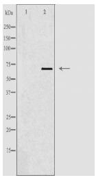 TBX18 Antibody