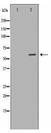 TYR Antibody