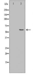 LYN Antibody