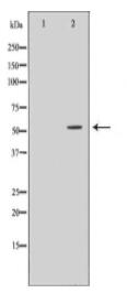 LCK Antibody