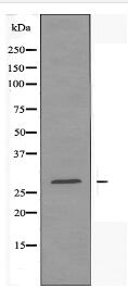 SCN4B Antibody