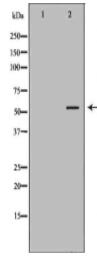 KRT4 Antibody