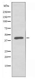 TNFRSF10D Antibody