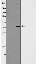 PIAS4 Antibody