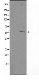 RAD23B Antibody
