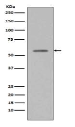 Phospho-p53 (S33) Antibody