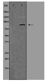 TLK1 Antibody