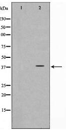 CD226/DNAM-1 Antibody