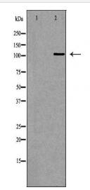 RB1 Antibody