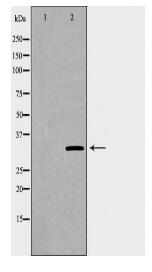 SULT1A1 Antibody