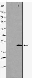 PRKRA Antibody