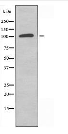 RPS6KC1 Antibody