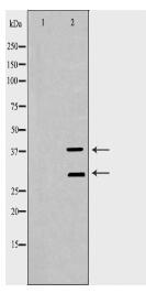 RAD1 Antibody