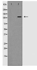 EPHB2 Antibody