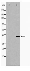 NUDT6 Antibody