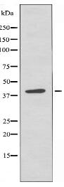 PTX3 Antibody