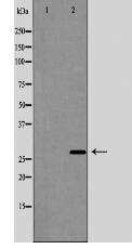 AQP5 Antibody